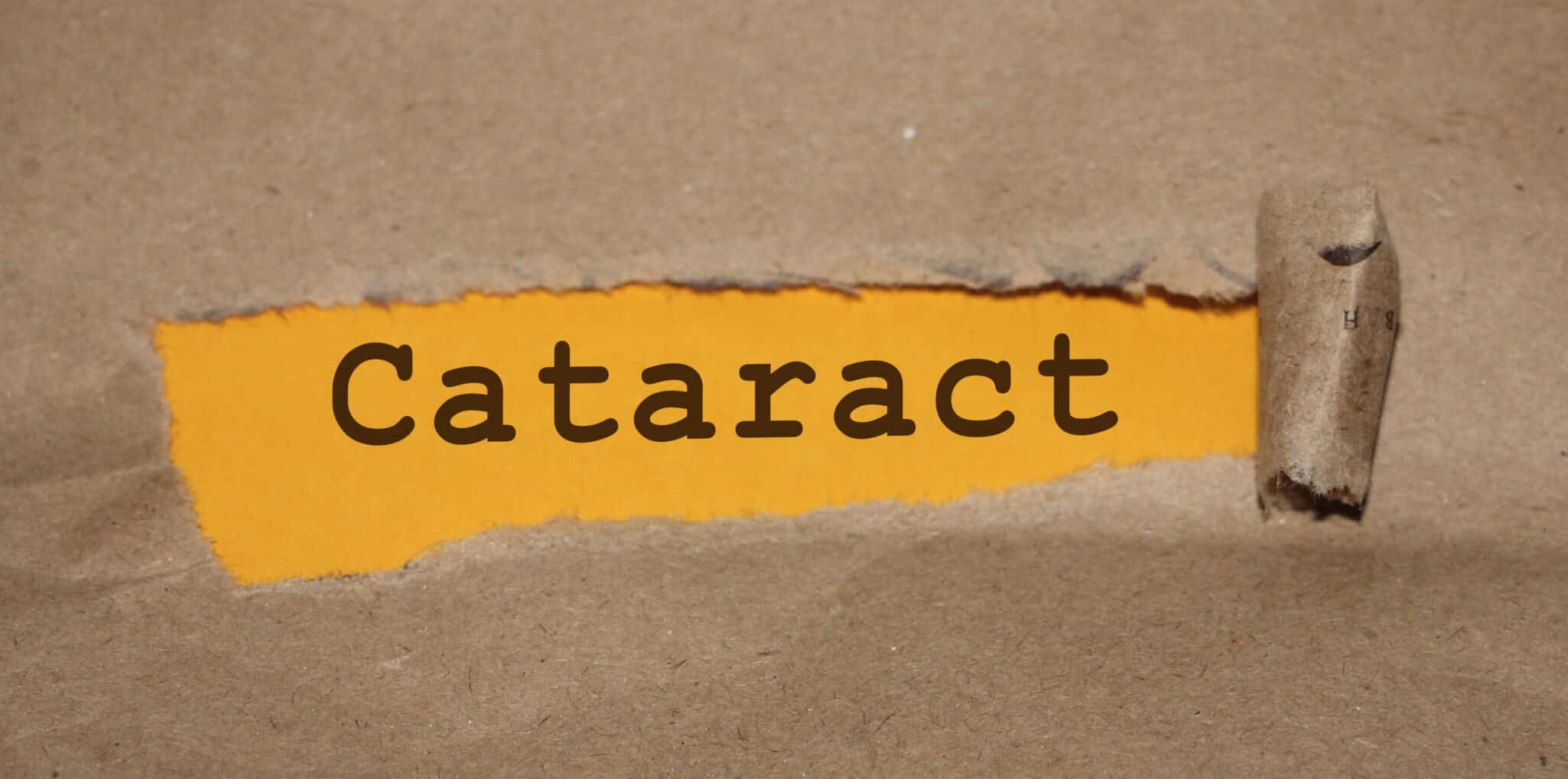 Cataract word written under brown torn paper. Eyes healthcare concept